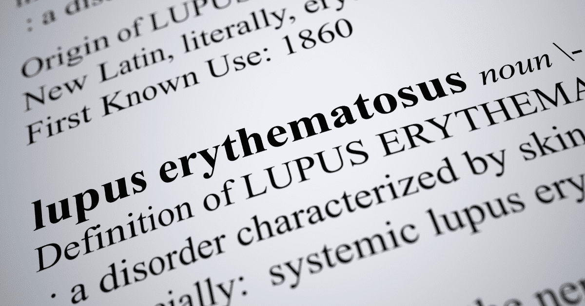 Lupus erythematous