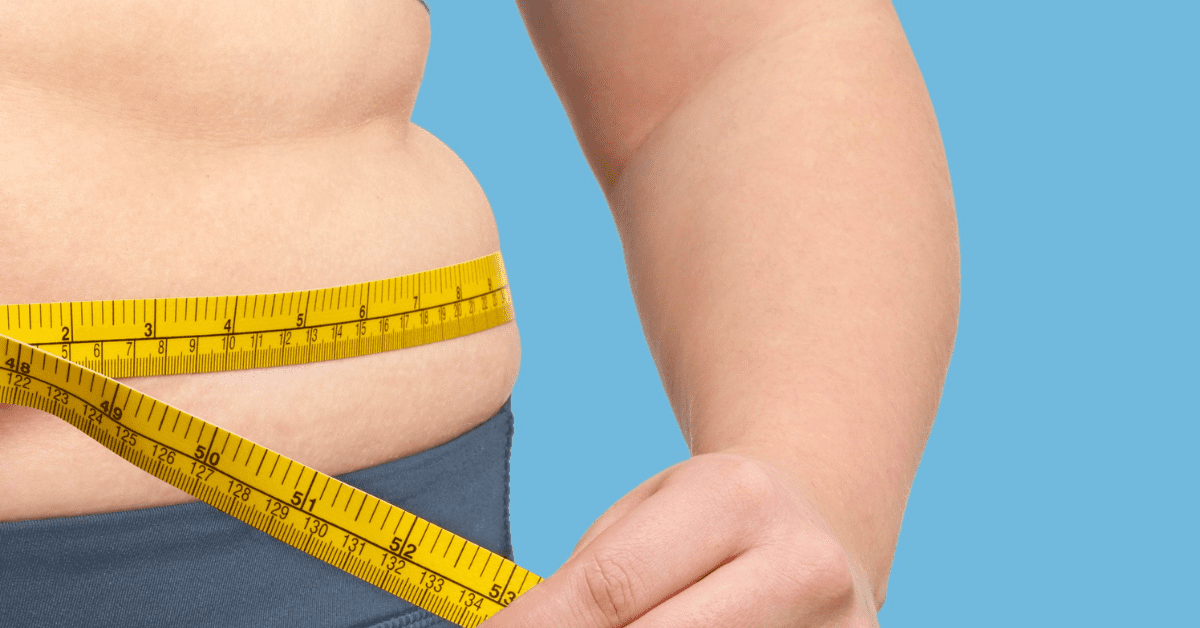Obesity can make you Vitamin D deficient with lupus