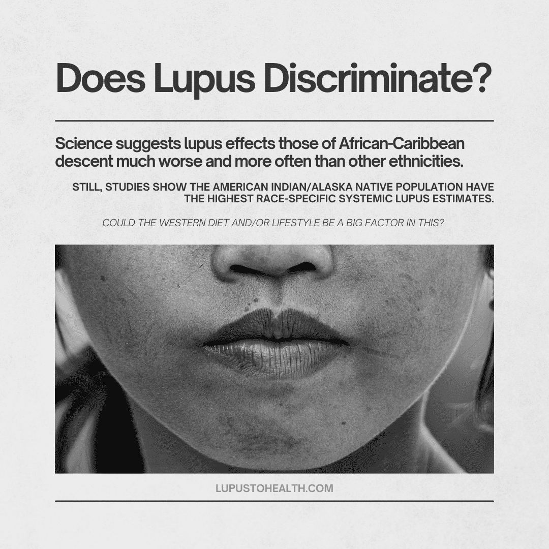 Lupus appears to effect the BAME ethnic group more