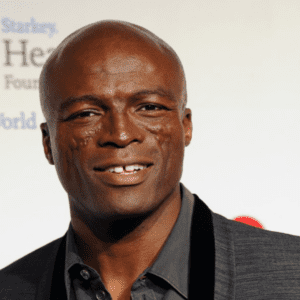 Seal's trademark scars are the result of lupus